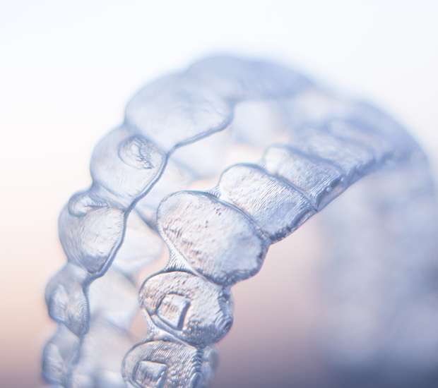 Miami ClearCorrect Braces