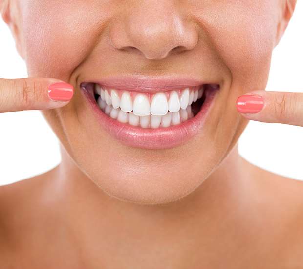 Miami What Is Gum Contouring and Reshaping